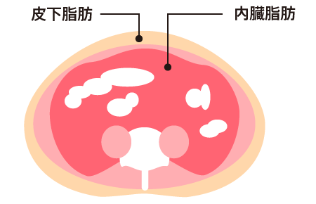 痩せるには皮下脂肪を落とす必要がある 皮下脂肪の落とし方を伝授 人生一度っきり 最高のカラダを手に入れよう